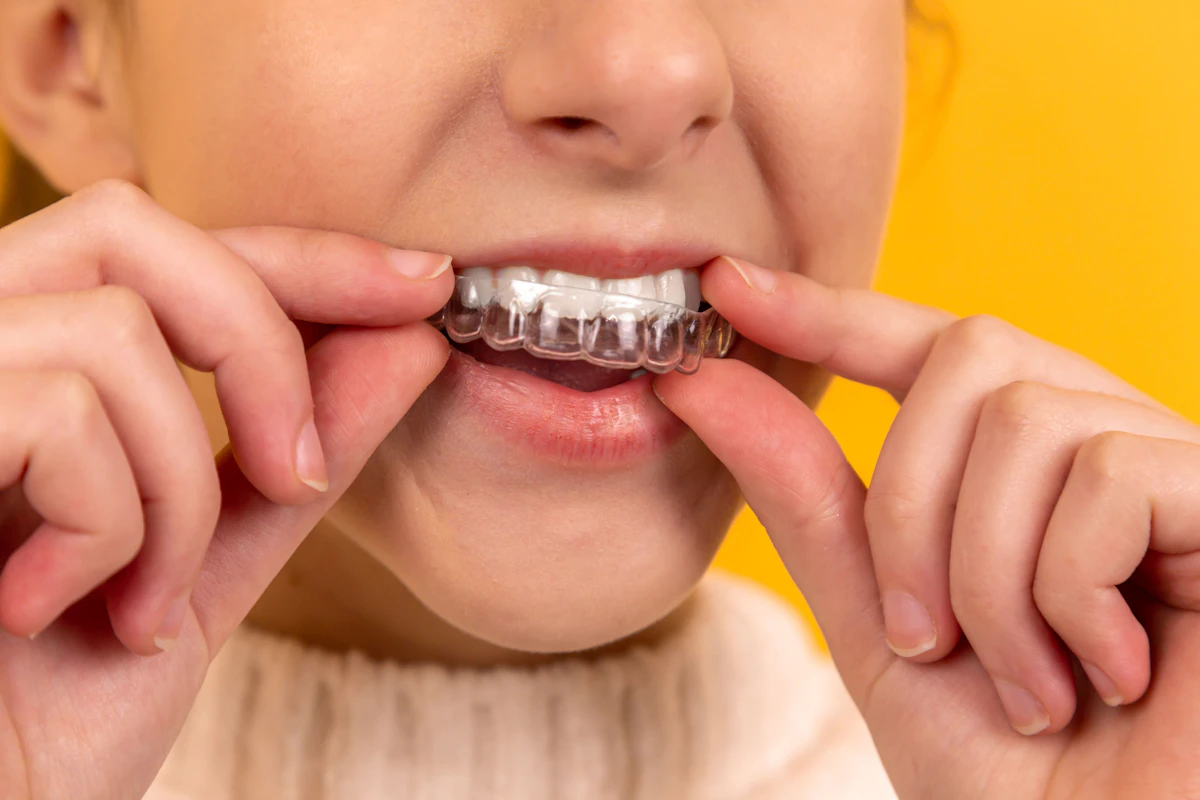 Studi dentistici per visite, igiene orale e urgenze a Biella e provincia